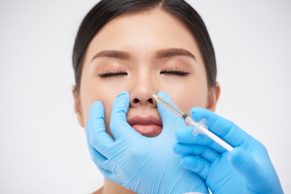 Nâng mũi bằng filler diễn ra nhanh, tạo dáng mũi cao đẹp